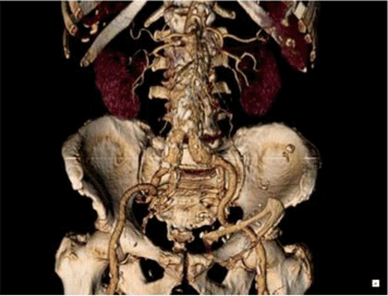 3d scanner medical imaging
 on An imaging solution that doesn't slow you down