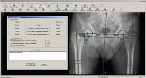 rogan view pro-x ortho