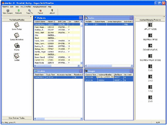 specific worklists specific worklists