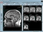 online PACS online pacs system