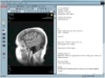 EPR,Pathology,Endoscopy,Nuclear Medicine EPR,Pathology,Endoscopy, and Nuclear Medicine are supported