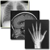 Image of multiple x-ray images