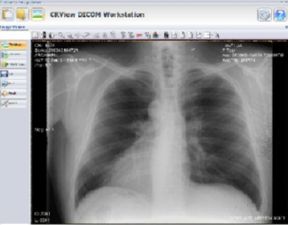 stored x-ray image
